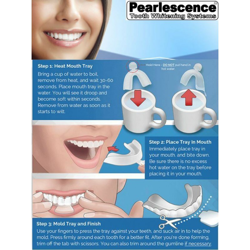 35 carbamide peroxide teeth whitening gel review